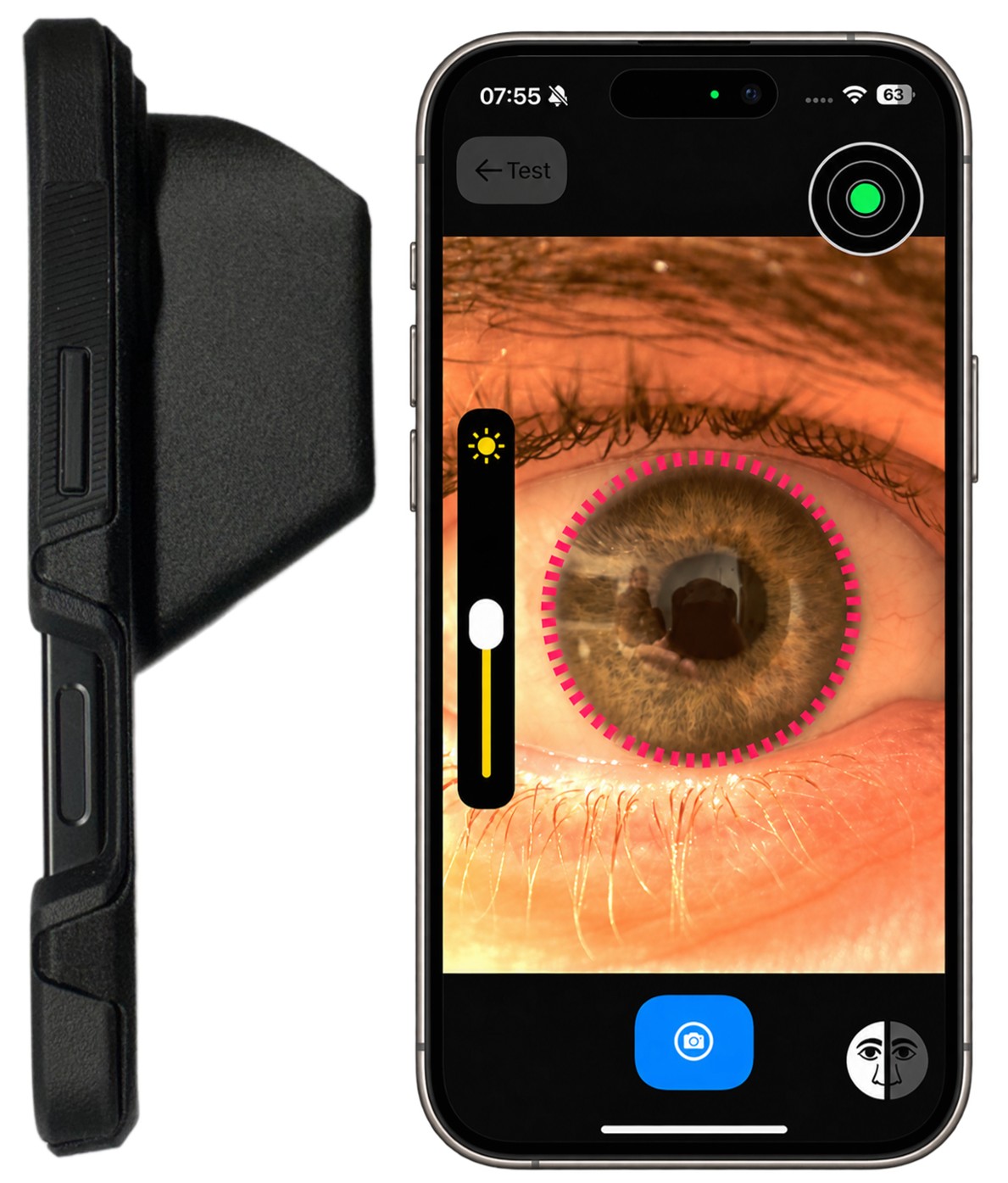 Myopia Detection